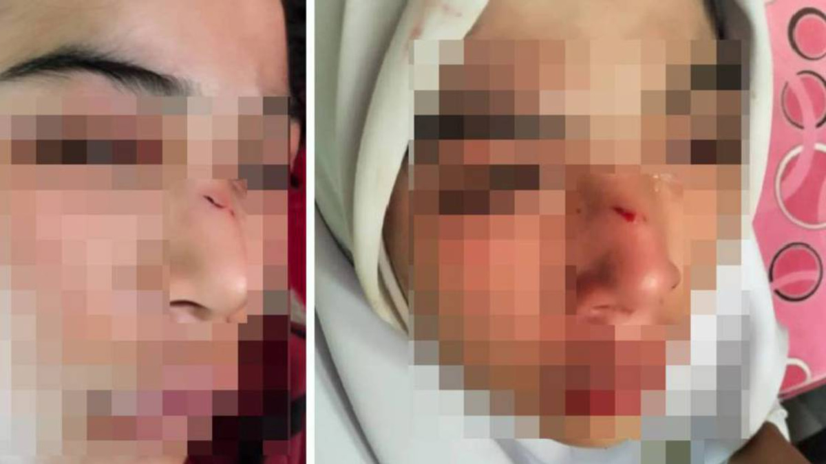 Kelantan Education Department launches probe into assault case involving 15-year-old student