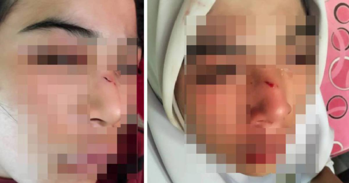 Kelantan Education Department launches probe into assault case involving 15-year-old student