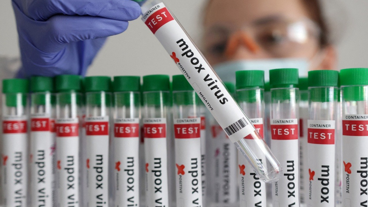 Guinea-Bissau Confirms First Mpox Case as Health Authorities Launch Response