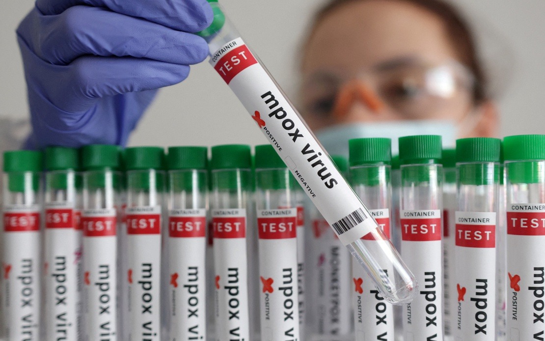 Guinea-Bissau Confirms First Mpox Case as Health Authorities Launch Response