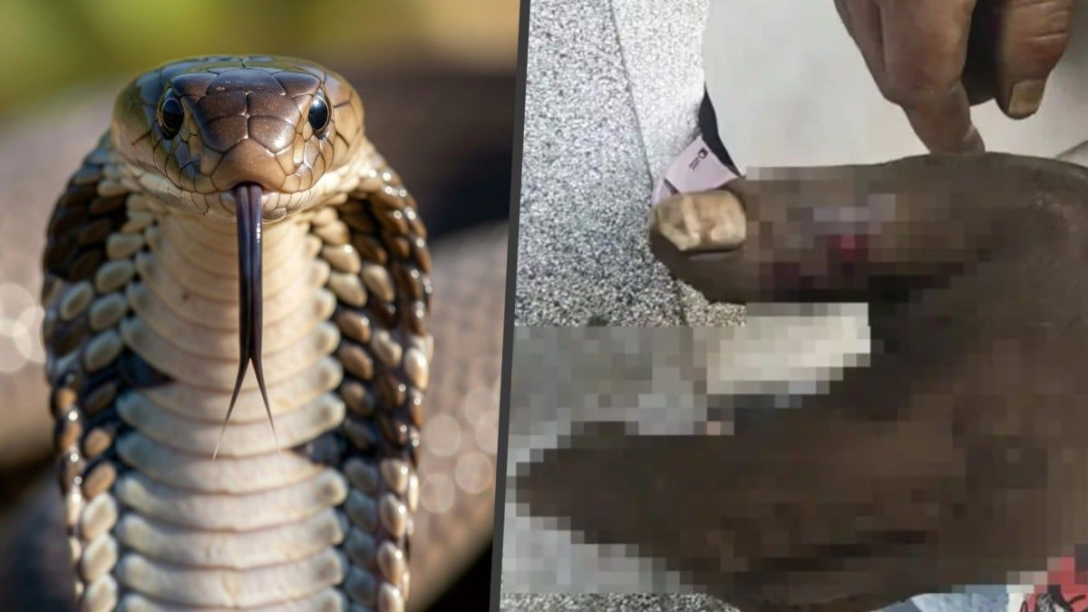 Woman's Televised First-Aid Technique Backfires, Poisoning Herself After Cobra Bites Husband in China