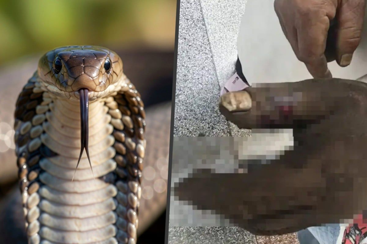 Woman's Televised First-Aid Technique Backfires, Poisoning Herself After Cobra Bites Husband in China