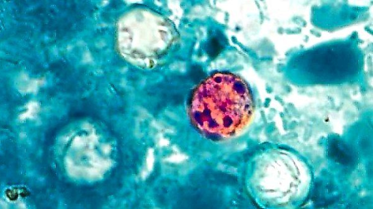 The invisible threat: Why Cyclospora parasites evade detection and complicate food safety investigations