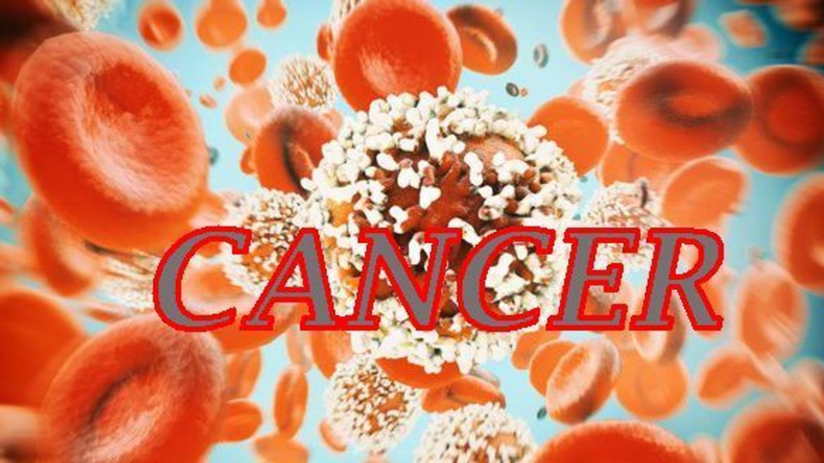 The Silent Threat: Why Young People Must Not Ignore Colorectal Cancer Warning Signs