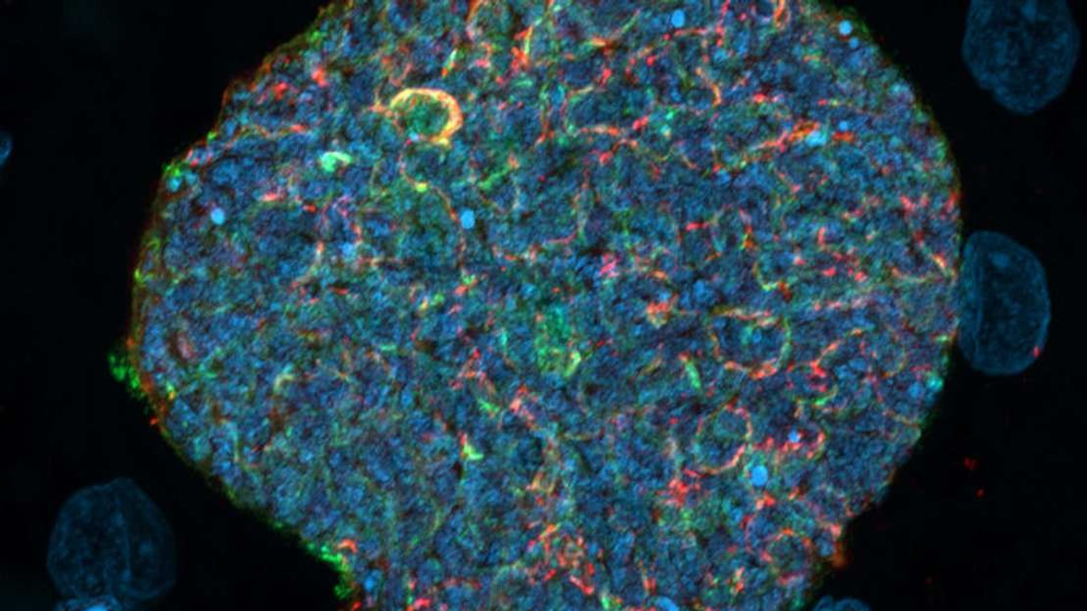 Australian Researchers Transform Mosquito Bites Into Malaria Immunity Boosters