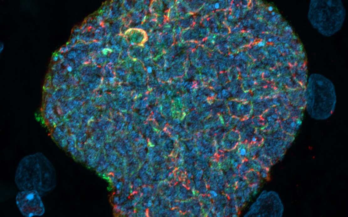 Australian Researchers Transform Mosquito Bites Into Malaria Immunity Boosters