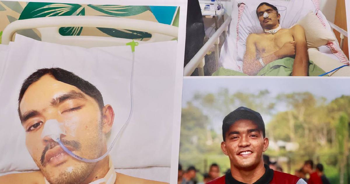 Malaysian Army Concludes Investigation Into Johor Camp Injury; Dismissals Proceeding