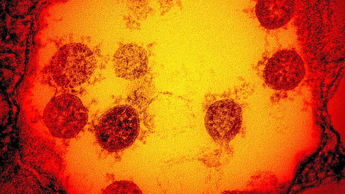 Cambridge Scientists Develop 'Master Key' Vaccine Technology to Combat Pandemic Viruses