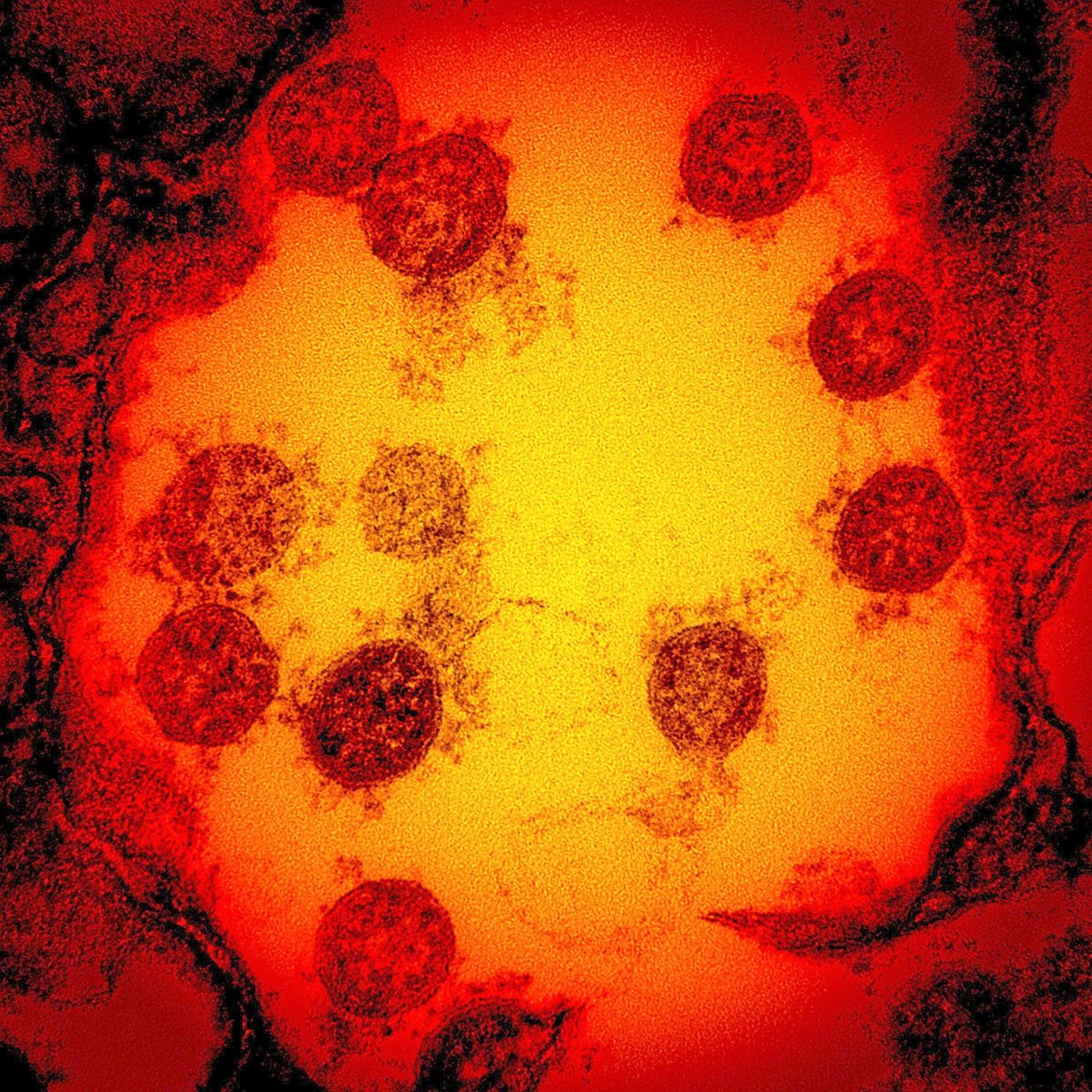 Cambridge Scientists Develop 'Master Key' Vaccine Technology to Combat Pandemic Viruses